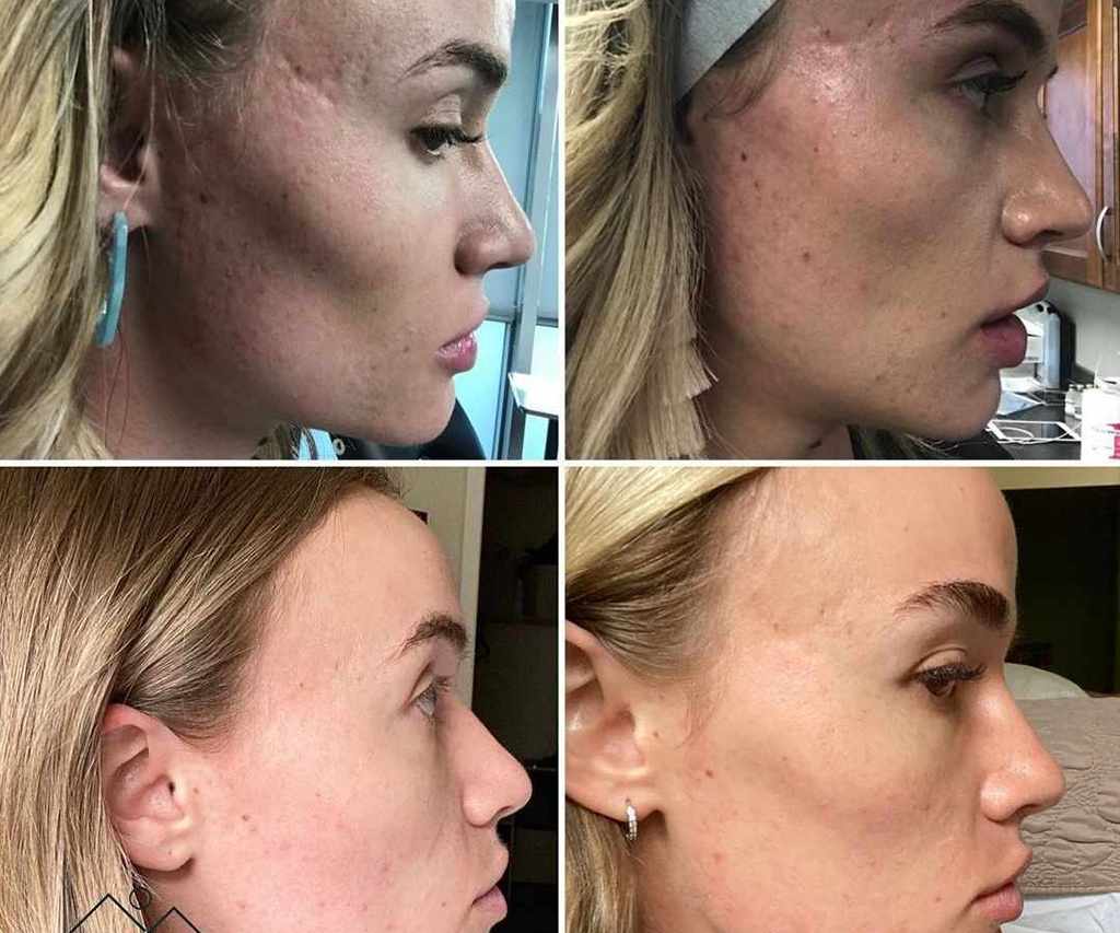 Before-After15-compressed