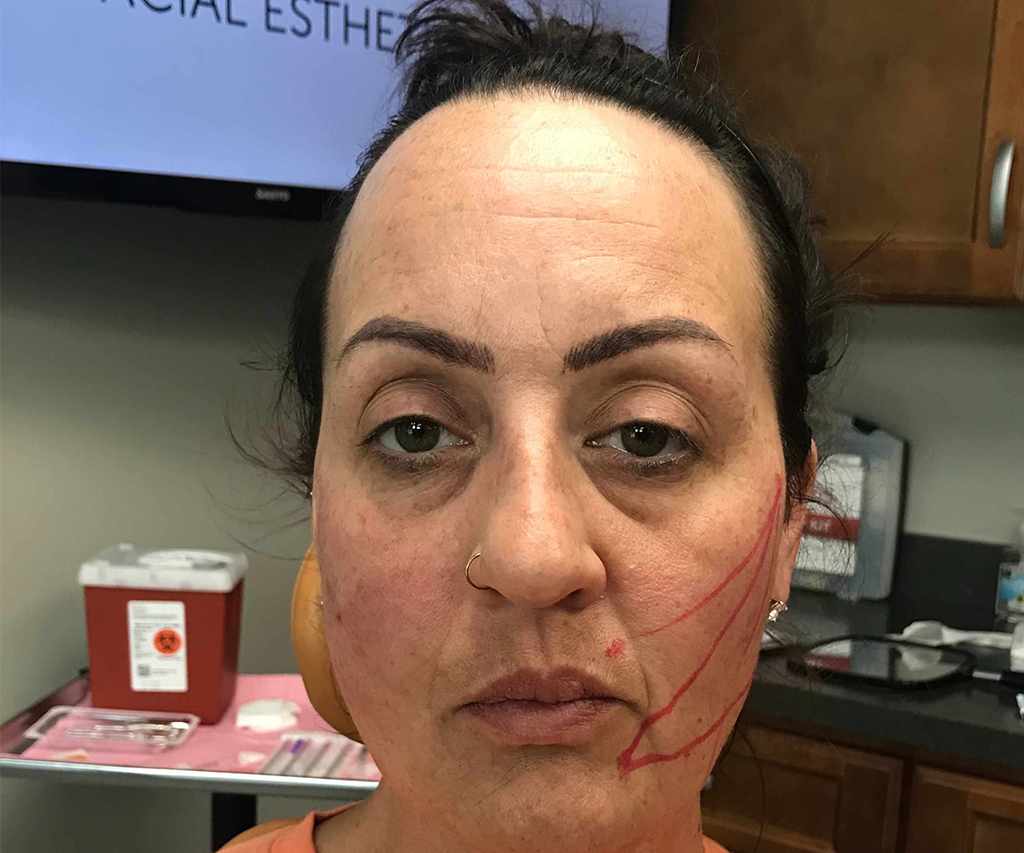 Before-After16-compressed