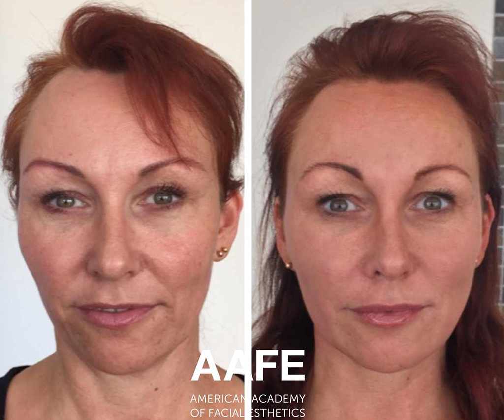 Before-After5-compressed