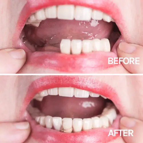 Happy young woman showing bright smile in dental office, Northshore Dentistry | Glenview, IL