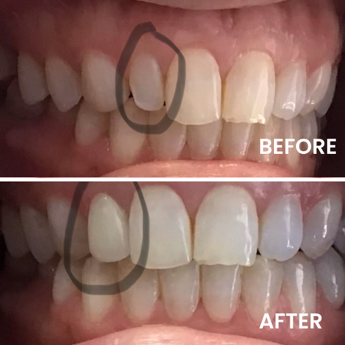 Smiling woman in dental exam chair with dentist using tablet, Northshore Dentistry | Glenview, ILGroup | Glenview